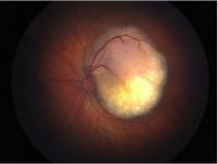 Close up of eye