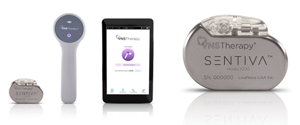 Vagus Nerve Stimulation (VNS)