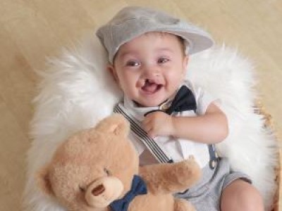 Baby with cleft palate, smiling and holding teddy bear